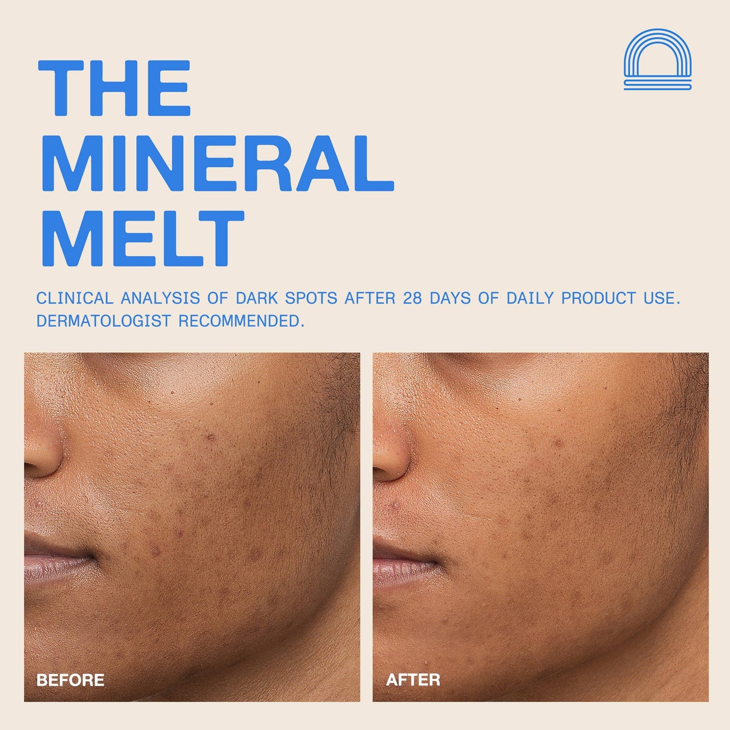 The Mineral Melt by Dune Suncare